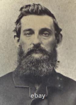 2 General Nichols Civil War Cdv New York studio photograph. Wounded in Battle